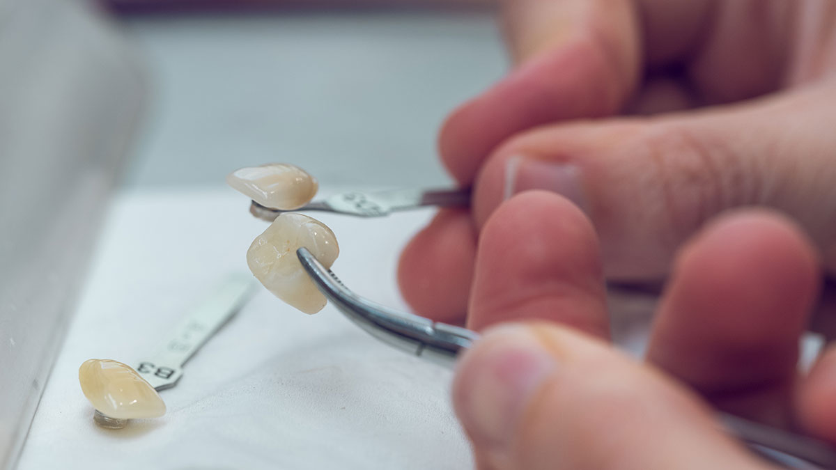 Coroane, fațete și proteze dentare realizate cu precizie digitală