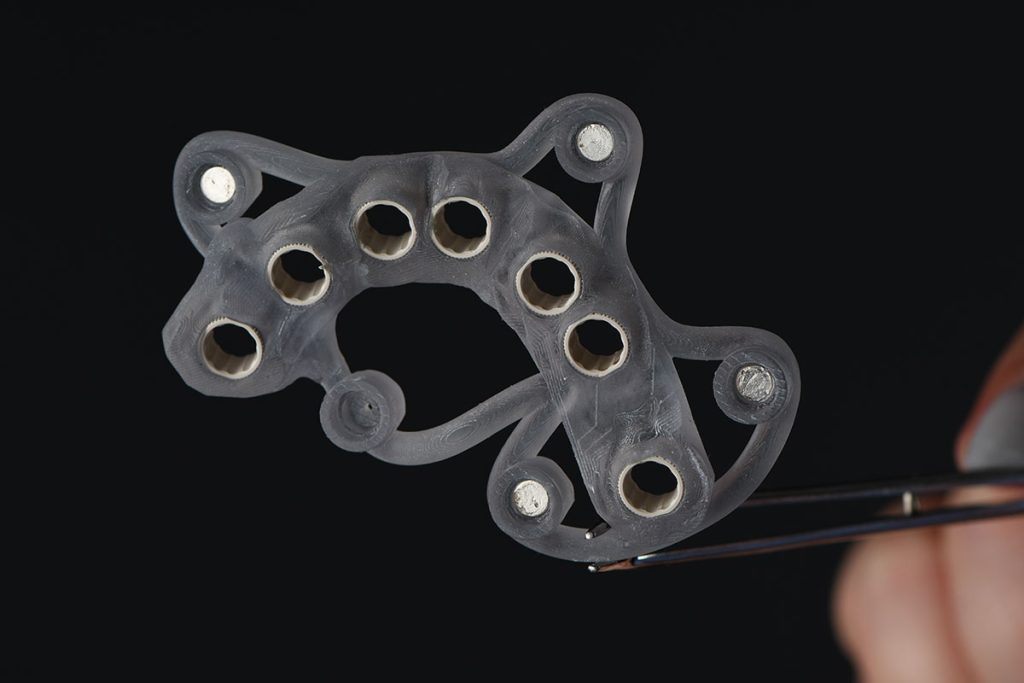 Ghid chirurgical și colaborarea cu medicul stomatolog