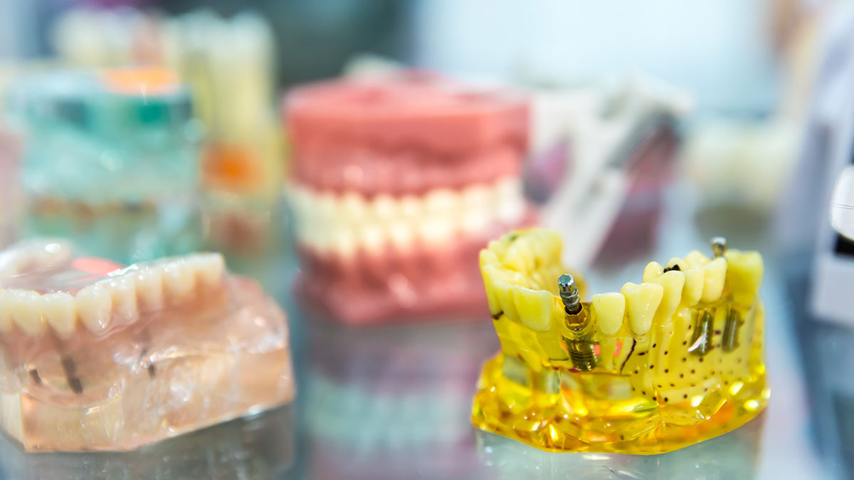 Factori care influențează prețul lucrărilor dentare